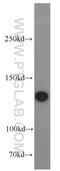 Splicing Factor 3b Subunit 3 antibody, 14577-1-AP, Proteintech Group, Western Blot image 