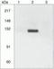 Integrin Subunit Beta 3 antibody, GTX25190, GeneTex, Immunoprecipitation image 