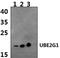 Ubiquitin Conjugating Enzyme E2 G1 antibody, PA5-75943, Invitrogen Antibodies, Western Blot image 