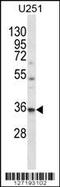 VPS37B Subunit Of ESCRT-I antibody, 56-419, ProSci, Western Blot image 