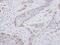 Ro60, Y RNA Binding Protein antibody, NBP1-32125, Novus Biologicals, Immunohistochemistry paraffin image 