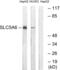 Solute Carrier Family 5 Member 6 antibody, abx014909, Abbexa, Western Blot image 