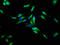 Cholinergic Receptor Nicotinic Beta 3 Subunit antibody, LS-C674998, Lifespan Biosciences, Immunofluorescence image 