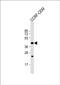 Protein Prenyltransferase Alpha Subunit Repeat Containing 1 antibody, PA5-72542, Invitrogen Antibodies, Western Blot image 