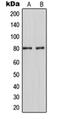 Myristoylated Alanine Rich Protein Kinase C Substrate antibody, orb214209, Biorbyt, Western Blot image 