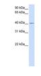 Solute Carrier Family 35 Member F6 antibody, NBP1-91306, Novus Biologicals, Western Blot image 