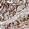 Alpha Kinase 2 antibody, PA5-55763, Invitrogen Antibodies, Immunohistochemistry paraffin image 