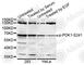 3-Phosphoinositide Dependent Protein Kinase 1 antibody, AP0477, ABclonal Technology, Western Blot image 