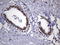 MutS Homolog 2 antibody, LS-C799254, Lifespan Biosciences, Immunohistochemistry paraffin image 