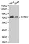 Potassium Voltage-Gated Channel Subfamily D Member 2 antibody, MBS127366, MyBioSource, Western Blot image 