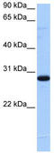 Transcription Elongation Factor A N-Terminal And Central Domain Containing 2 antibody, TA339810, Origene, Western Blot image 