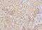 NIPBL Cohesin Loading Factor antibody, NBP1-52168, Novus Biologicals, Immunohistochemistry paraffin image 