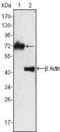 Zeta Chain Of T Cell Receptor Associated Protein Kinase 70 antibody, MA5-15281, Invitrogen Antibodies, Western Blot image 