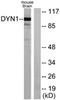 Dynamin 1 antibody, LS-C117603, Lifespan Biosciences, Western Blot image 