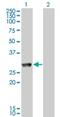 Glycerol Kinase 5 antibody, H00256356-M11, Novus Biologicals, Western Blot image 