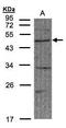 F-Box And WD Repeat Domain Containing 2 antibody, GTX104863, GeneTex, Western Blot image 