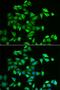 Uncharacterized glycosyltransferase AGO61 antibody, MBS9126021, MyBioSource, Immunofluorescence image 