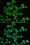 Protein O-Linked Mannose N-Acetylglucosaminyltransferase 2 (Beta 1,4-) antibody, MBS9126021, MyBioSource, Immunofluorescence image 