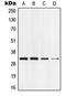 N-arachidonyl glycine receptor antibody, LS-C352266, Lifespan Biosciences, Western Blot image 