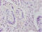 Ribosomal Protein L14 antibody, A52992-100, Epigentek, Immunohistochemistry paraffin image 
