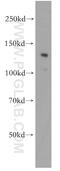 Apoptotic Peptidase Activating Factor 1 antibody, 21710-1-AP, Proteintech Group, Western Blot image 