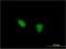 TSH1 antibody, H00010194-M07, Novus Biologicals, Immunocytochemistry image 