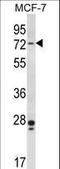 P21 (RAC1) Activated Kinase 4 antibody, LS-B10177, Lifespan Biosciences, Western Blot image 