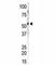 Calcium/Calmodulin Dependent Protein Kinase II Gamma antibody, F40148-0.4ML, NSJ Bioreagents, Western Blot image 