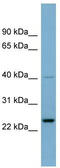 NOP16 Nucleolar Protein antibody, TA345030, Origene, Western Blot image 