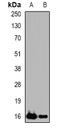 Phospholipase A2 Group IID antibody, LS-C482679, Lifespan Biosciences, Western Blot image 