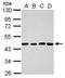 Solute Carrier Family 46 Member 2 antibody, GTX119204, GeneTex, Western Blot image 