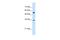 Signal Sequence Receptor Subunit 1 antibody, A06993, Boster Biological Technology, Western Blot image 