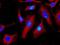 Cathepsin B antibody, ab125067, Abcam, Immunofluorescence image 