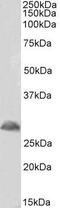 Triggering Receptor Expressed On Myeloid Cells 2 antibody, GTX47596, GeneTex, Western Blot image 