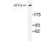 Acetyl-CoA Carboxylase Alpha antibody, LS-C176258, Lifespan Biosciences, Western Blot image 