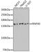 Ring Finger Protein 40 antibody, GTX33467, GeneTex, Western Blot image 