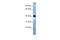 Transmembrane Protein 115 antibody, A12827, Boster Biological Technology, Western Blot image 