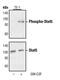 Signal Transducer And Activator Of Transcription 5A antibody, MA5-15189, Invitrogen Antibodies, Western Blot image 