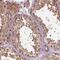 Proteasome 26S Subunit, Non-ATPase 11 antibody, NBP2-55793, Novus Biologicals, Immunohistochemistry paraffin image 