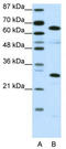 High Mobility Group Box 4 antibody, TA345519, Origene, Western Blot image 