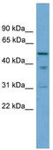 Tubulointerstitial Nephritis Antigen antibody, TA334540, Origene, Western Blot image 