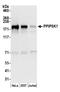 Diphosphoinositol Pentakisphosphate Kinase 1 antibody, A304-921A, Bethyl Labs, Western Blot image 