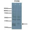 Pyrroline-5-Carboxylate Reductase 2 antibody, TA334474, Origene, Western Blot image 