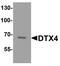 Deltex E3 Ubiquitin Ligase 4 antibody, PA5-72842, Invitrogen Antibodies, Western Blot image 