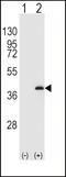 Protein Phosphatase 1 Catalytic Subunit Beta antibody, LS-C101012, Lifespan Biosciences, Western Blot image 