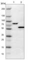 Solute Carrier Family 22 Member 2 antibody, NBP1-89417, Novus Biologicals, Western Blot image 
