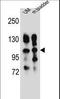 Integrin Subunit Alpha 5 antibody, LS-C165316, Lifespan Biosciences, Western Blot image 