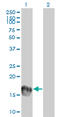 Ubiquitin Conjugating Enzyme E2 C antibody, LS-B12179, Lifespan Biosciences, Western Blot image 