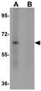LYR Motif Containing 2 antibody, GTX85197, GeneTex, Western Blot image 