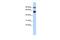 BAF Chromatin Remodeling Complex Subunit BCL11A antibody, PA5-41589, Invitrogen Antibodies, Western Blot image 